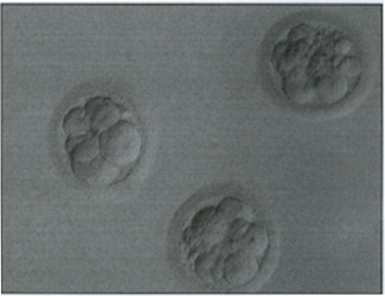 Three embryos in a dish